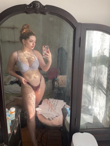 Tucson BodyRubs Offered By (585)284-7253 | Bodyrubs (585)284-7253 is otherand offers nuru massages, asian massage, bodyrubs in Tucson and available for both on rubrankings I’m available both Incall and outcall EXCLUSIVES INCLUDE:
(lingerie, hot oil & towel treatment, soothing Music, A/C, aromatherapy, bottled water, hygiene essentials, spa-like setting,
✅✅✅ I prefer to see a very few select upscale gentlemen and don't care about quantity at all. I am looking for QUALITY, which is what you will get with me!
The first step is to simply reach out to me by sending a text. I do not answer phone calls at first ✅✅
I smell nice and have a wet tight pussy
you can never regret meeting me
✅GFE
✅69 position
✅anal
✅rich kissing
☑️ Golden shower
✅doggy
✅raw
✅420 friendly
✅bbj
✅ No free FaceTime I charge for my FaceTime
WhatsApp: +1 (585) 284-7253
Telegram: +1 (585) 284-7253
24/7__Discreet Blow job 💋💦
I still want to have a sex life. I need someone who can suck my kitty and a real man who loves to suck pussy
fuck me hard.. You can come to my place
I also sell registered and recommended hard pills 💊 to make you stronger and last long in bed
i hate fakers. I have Car Fun/Hotel-Fun. Bbw. Daty. Bareback blowjob.
Don't worry I have all services always prepared to satisfy. Completely I'm real and very honest I'm fun to chat with I don't snub +1 (585) 284-7253