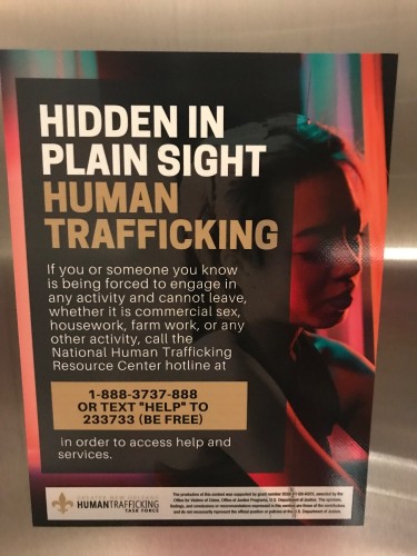 (111)111-1111 is Caucasianand offers nuru massages, asian massage, bodyrubs in Dallas and available for incall on rubrankings If you need help, there’s information in the picture. 